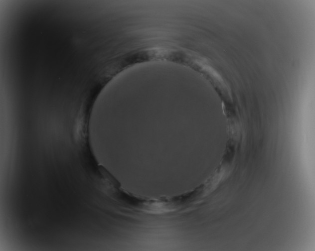 X0000087620419200705181316