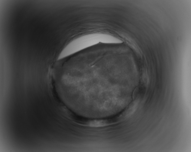 X0000087620461200705181316