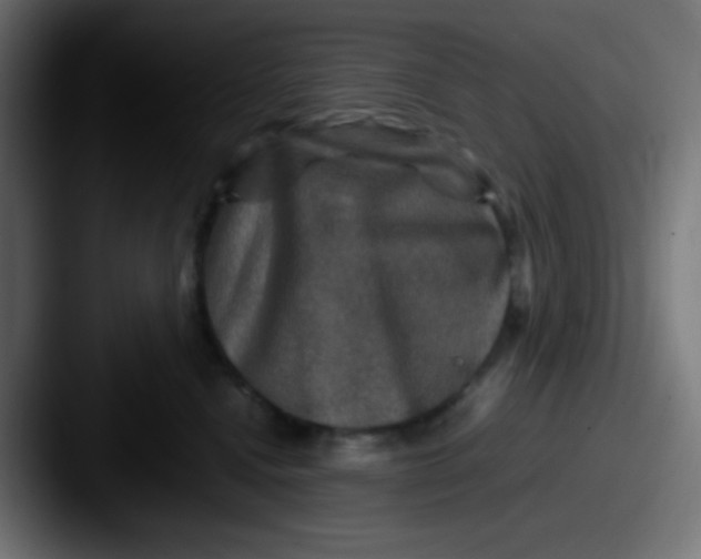 X0000087620472200705181316