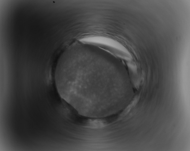 X0000087620520200705181315