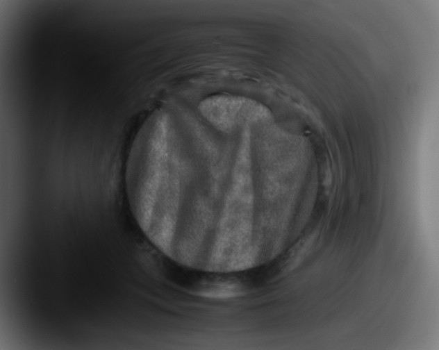 X0000087620559200705181315