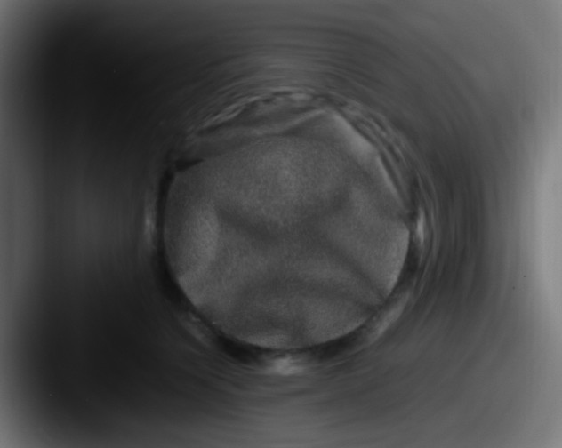 X0000087620564200705181315