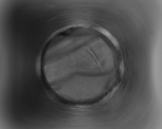 X0000087620580200705181314