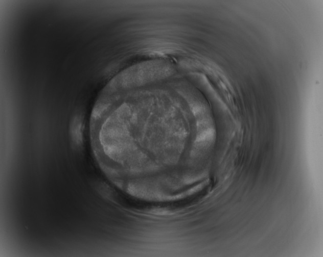 X0000087620596200705181314