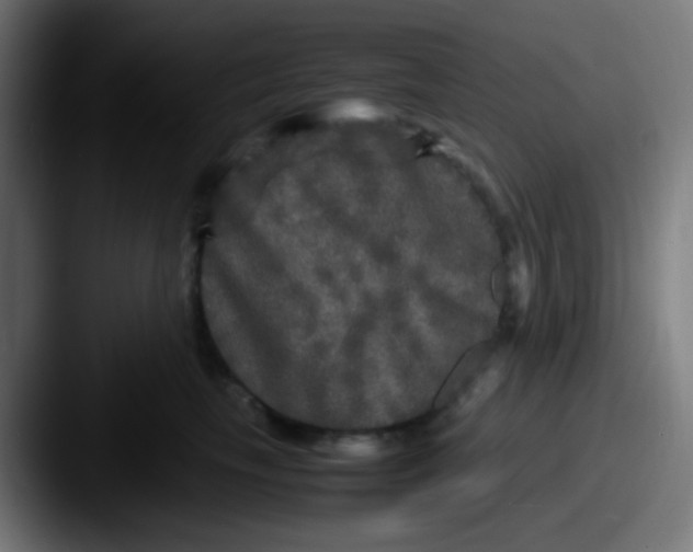 X0000087620665200705181314