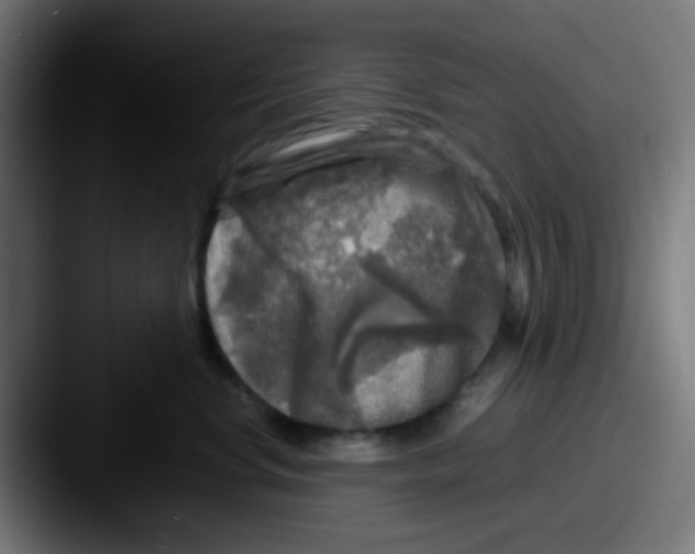 X0000087620668200705181314