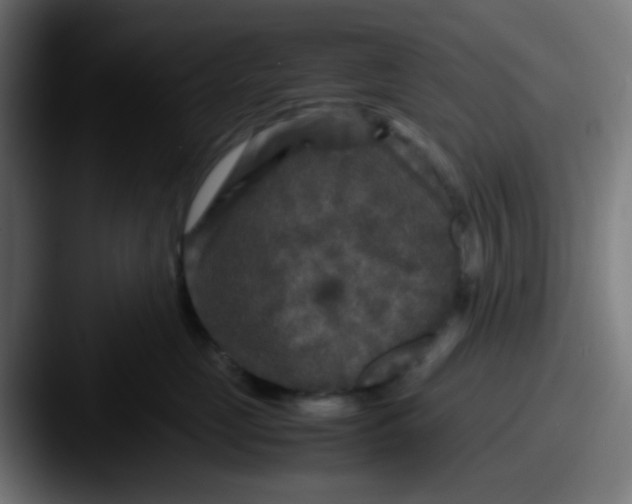 X0000087620669200705181314