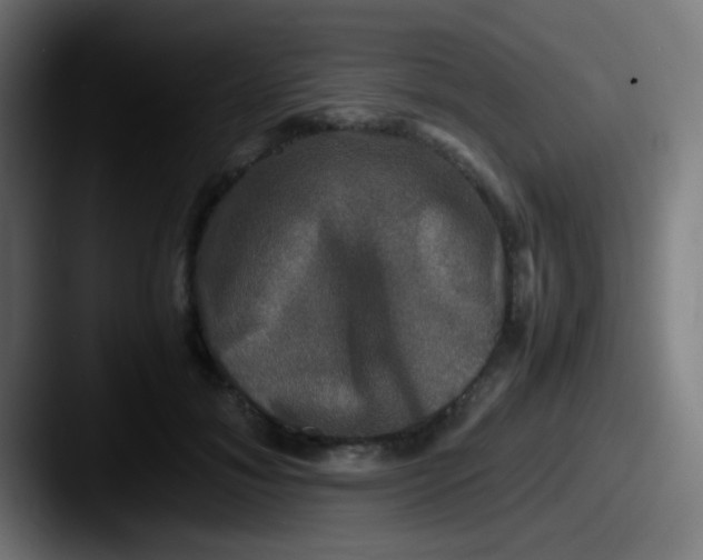 X0000087620700200705181313