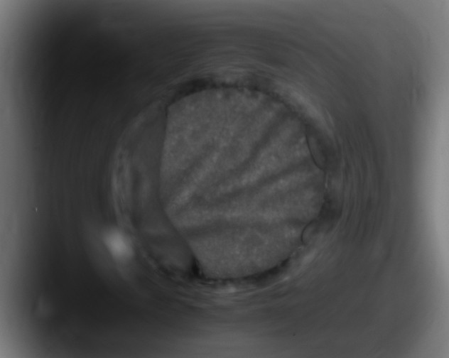 X0000087620817200705181311