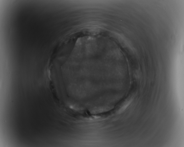 X0000087620818200705181311