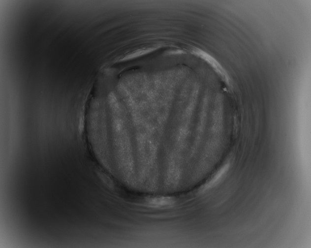 X0000087620833200705181311