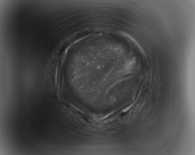 X0000087620919200705181310