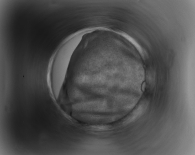 X0000087620959200705181311