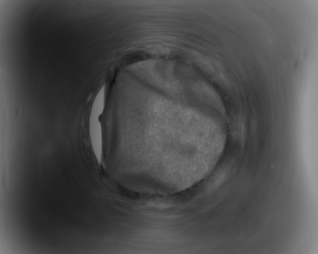 X0000087620962200705181310