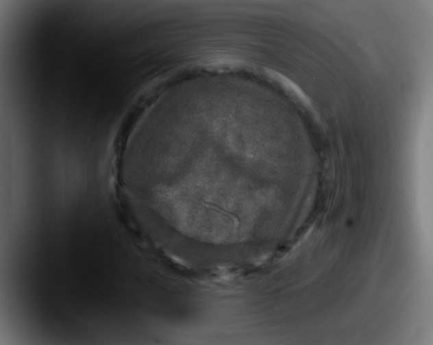 X0000087621016200705181309