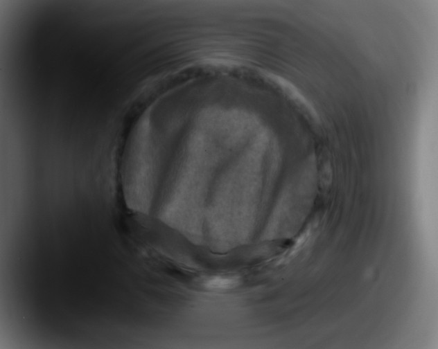 X0000087621110200705181308