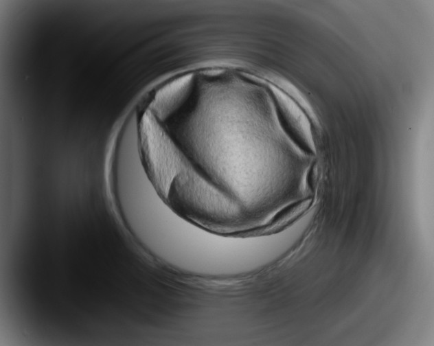 X0000087621140200705181308