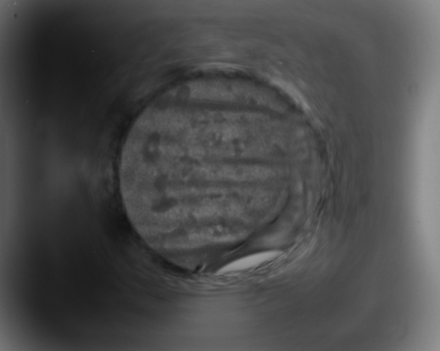 X0000087621159200705181308