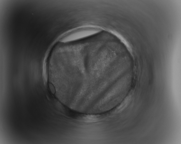 X0000087621175200705181308