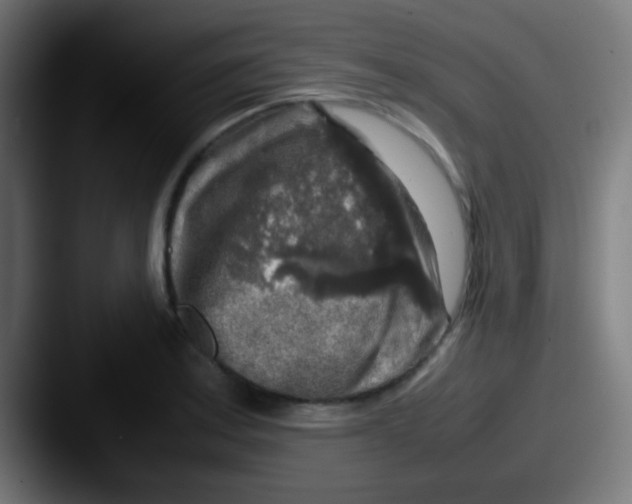 X0000087621179200705181307