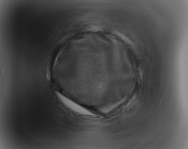 X0000087621206200705181307