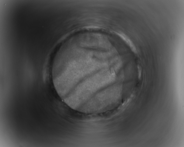 X0000087621208200705181307