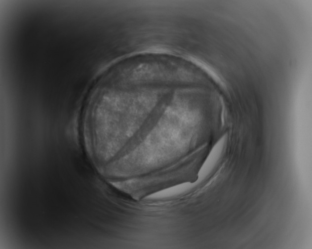 X0000087621264200705181306