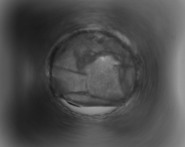X0000087621400200705181305