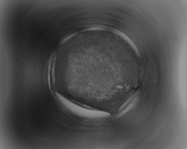 X0000087621417200705181305