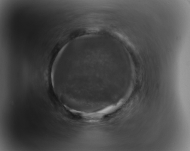 X0000087621445200705181304