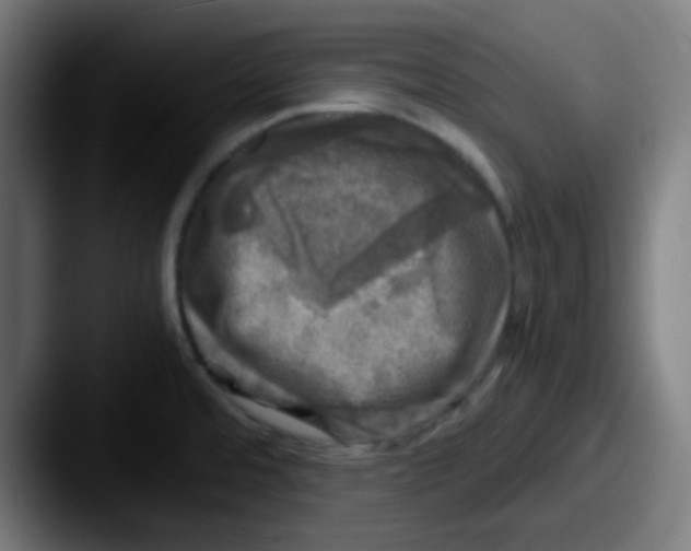 X0000087621480200705181304