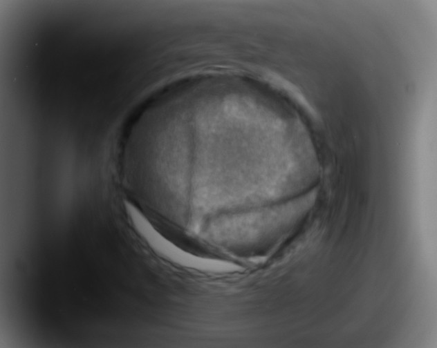 X0000087621496200705181303