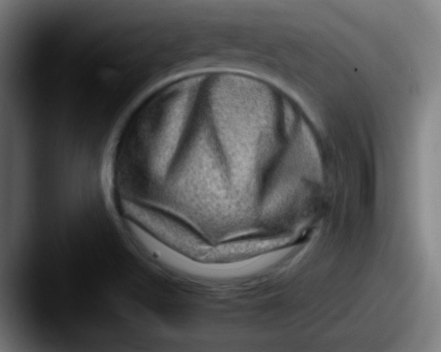 X0000087621511200705181304