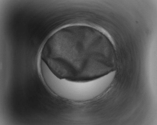X0000087621528200705181304