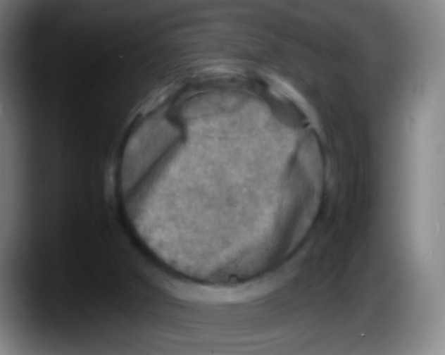 X0000087620010200705252012