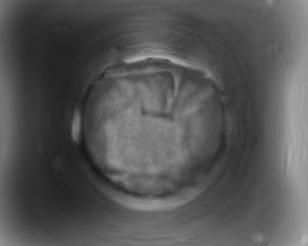 X0000087620014200705252012