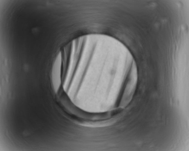 X0000087620017200705252012