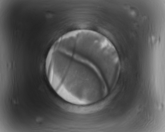 X0000087620018200705252012