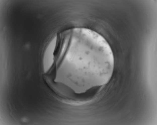 X0000087620019200705252012
