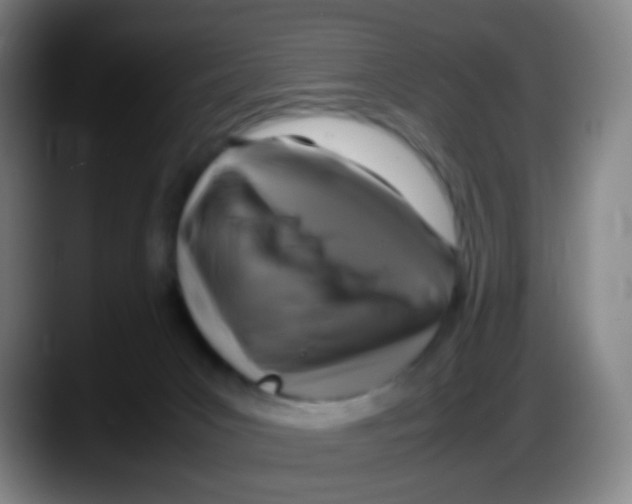 X0000087620031200705252011