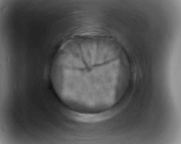 X0000087620034200705252011