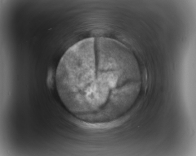 X0000087620038200705252011
