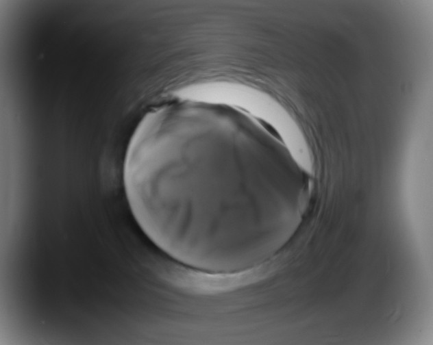 X0000087620039200705252011