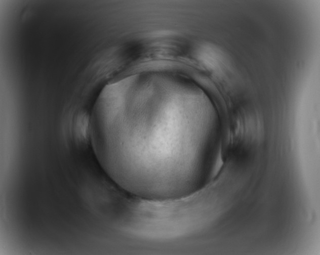 X0000087620041200705252011
