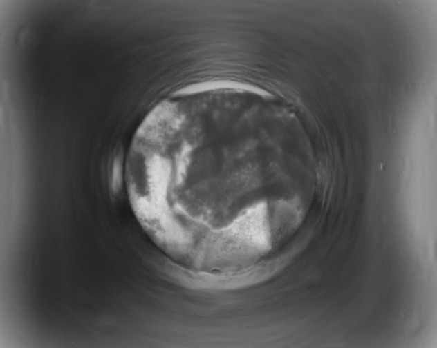 X0000087620046200705252011