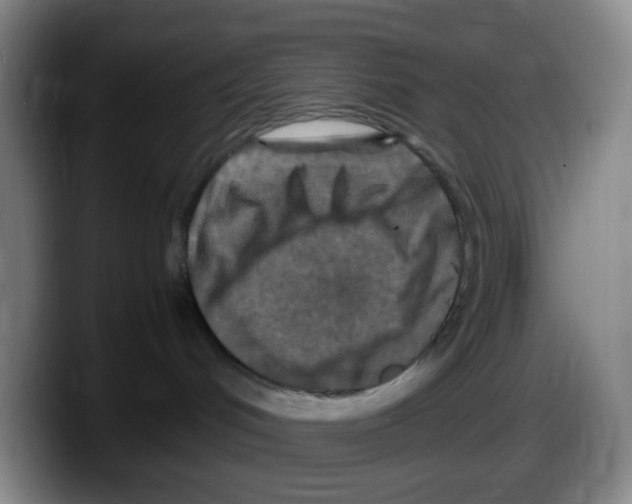 X0000087620048200705252011