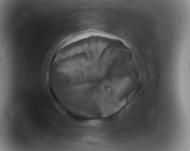 X0000087620050200705252011