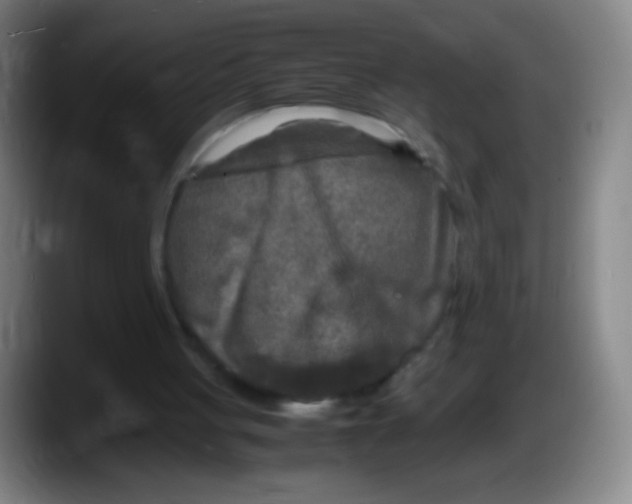X0000087620051200705252011