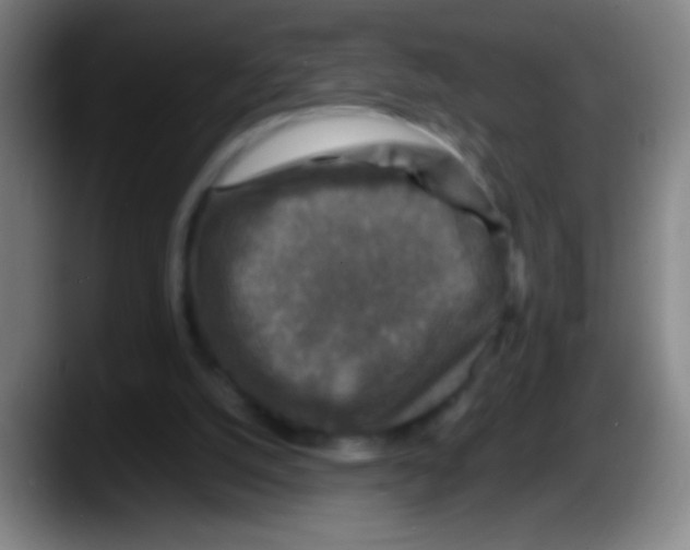 X0000087620056200705252011
