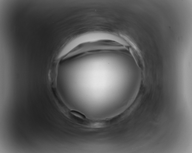 X0000087620057200705252011